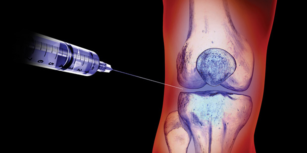 Infiltración de rodilla